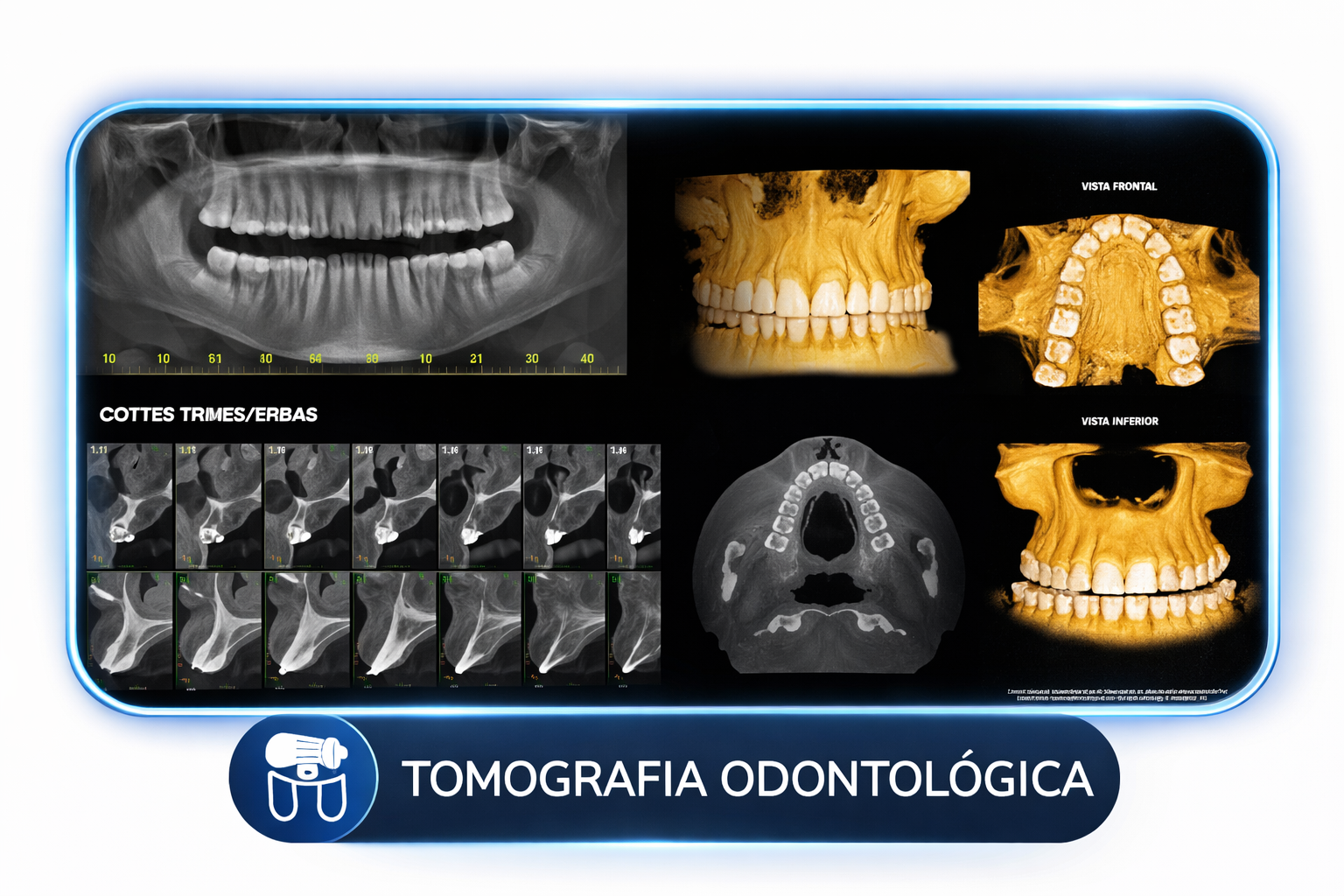 Tomografia odontológica 3D